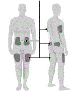 Choose your injection site. - Illustration
