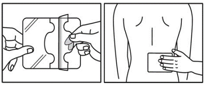 Open it to remove ZTLIDO - Illustration