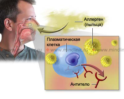 Попадание аллергена (цветочной пыльцы) в полость носа вызывает начало аллергической реакции.