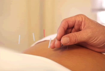 The use of acupuncture is very effective in the treatment of back and lower back pain associated with osteochondrosis of the spine with disc herniation or protrusion of the intervertebral disc.