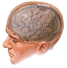 Arachnoiditis of the meninges of the brain is a consequence of trauma or concomitant infectious diseases of the brain or paranasal sinuses.