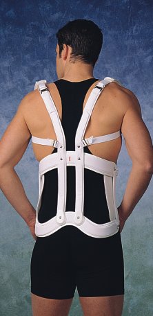 Wearing an extensor (extensional) brace in the treatment of a compression fracture of the spine with a decrease in the height of the vertebral body.