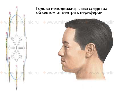 Выявление нистагма осуществляется путём слежения за объектом от центра к периферии при неподвижной голове пациента.