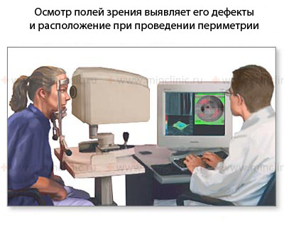 Осмотр полей зрения (периметрия) выявляет его дефекты и их расположение при проведении диагностической процедуры периметрии.