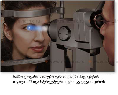 ნაპრალოვანი ნათურა გამოიყენება პაციენტის თვალის შიდა სტრუქტურის თვისებების შესამოწმებლად.