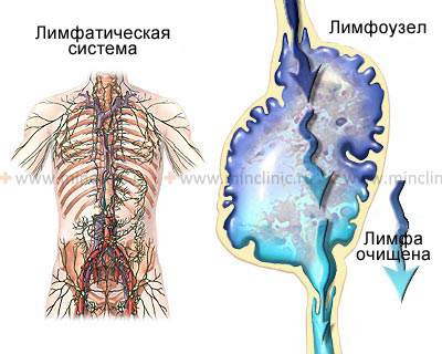 Anatomy of the human lymphatic system, showing the cleansing of lymph through the lymph node.