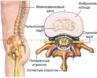 Vertebral anatomy: vertebral body, arch of the vertebra, articular processes of the vertebra, transverse processes of the vertebra, spinous process of the vertebra, intervertebral disc (nucleus pulposus and annulus fibrosus).