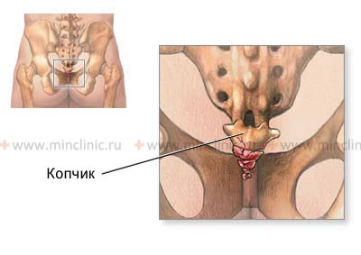 The presence of pain in the coccyx area (coccygodynia) requires a digital examination through the rectum.