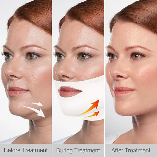 V Line Premium Face Lifting Mask